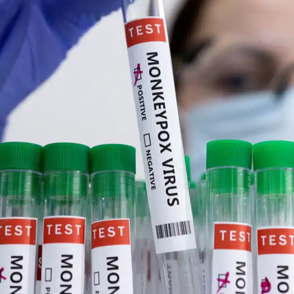 Will there be a spike in Mpox cases?